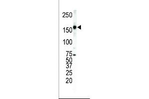 Western blot analysis of anti-ErbB4 Pab (ABIN391951 and ABIN2841749) in T-47D cell lysate.