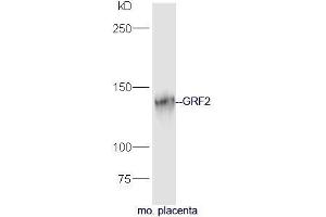 Mouse placenta lysate probed with Rabbit Anti-GRF2 Polyclonal Antibody, Unconjugated (ABIN2559496) at 1:300 in 4˚C. (Ras Protein-Specific Guanine Nucleotide-Releasing Factor 2 (RASGRF2) (AA 20-120) 抗体)