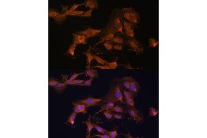 Immunofluorescence (IF) image for anti-Mitogen-Activated Protein Kinase Kinase 3 (MAP2K3) (AA 1-170) antibody (ABIN6143484)
