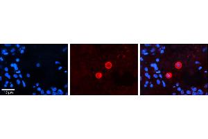 Immunohistochemistry (IHC) image for anti-Carboxylesterase 2 (CES2) (C-Term) antibody (ABIN2775271)