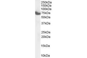 Image no. 2 for anti-Zinc Finger, DHHC-Type Containing 17 (ZDHHC17) (C-Term) antibody (ABIN185335)
