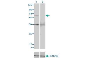 Western blot analysis of MMP13 over-expressed 293 cell line, cotransfected with MMP13 Validated Chimera RNAi (Lane 2) or non-transfected control (Lane 1). (MMP13 抗体  (AA 362-471))