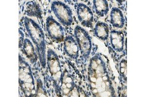 IHC analysis of FABP6 using anti-FABP6 antibody (ABIN7598974). (FABP6 抗体  (AA 1-128))