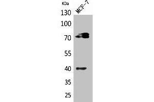 Western Blot analysis of MCF7 cells using CD110 Polyclonal Antibody. (MPL 抗体  (Internal Region))