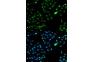 Immunofluorescence analysis of HeLa cells using FKBP3 antibody. (FKBP3 抗体)