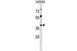 Western Blotting (WB) image for anti-Trophoblast Glycoprotein (TPBG) antibody (ABIN2999221) (TPBG 抗体)
