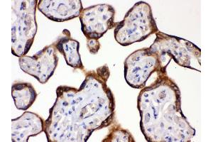 Anti- HSD11B2 antibody, IHC(P) IHC(P): Human Placenta Tissue (HSD11B2 抗体  (C-Term))