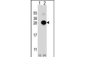 Western blot analysis of MOBKL1B (arrow) using rabbit polyclonal MOBKL1B Antibody (C-term) (ABIN391568 and ABIN2841505). (MOB1A 抗体  (C-Term))