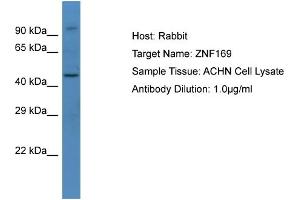 Host: Rabbit Target Name: ZNF169 Sample Type: ACHN Whole cell lysates Antibody Dilution: 1. (ZNF169 抗体  (C-Term))