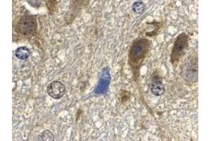Immunohistochemistry of GbL in mouse brain tissue with GbL antibody at 10 μg/ml. (GBL 抗体)