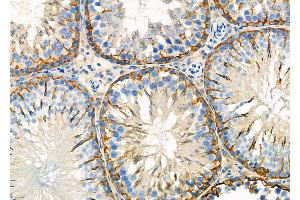 ABIN6264430 and ABIN6277577 at 1/100 staining Rat testis tissue by IHC-P.
