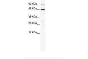 Image no. 1 for anti-T-Bet (AA 455-504) antibody (ABIN202721) (T-Bet 抗体  (AA 455-504))