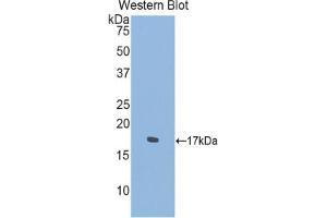 Western blot analysis of the recombinant protein. (SEMA4D/CD100 抗体  (AA 502-636))