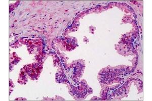 Human Prostate: Formalin-Fixed, Paraffin-Embedded (FFPE). (MMP3 抗体)