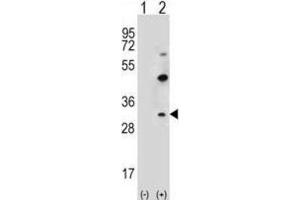 Western Blotting (WB) image for anti-Claudin 2 (CLDN2) antibody (ABIN2996860) (Claudin 2 抗体)