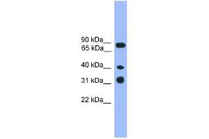 WB Suggested Anti-LAX1 Antibody Titration: 0. (LAX1 抗体  (C-Term))