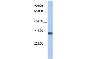 MLF1 antibody used at 1 ug/ml to detect target protein. (MLF1 抗体  (N-Term))