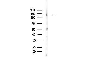 anti-Adenylate Cyclase 8 (Brain) (ADCY8) (Internal Region) antibody