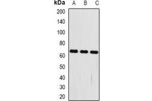 Western blot analysis of FRZB expression in mouse kidney (A), mouse heart (B), mouse brain (C) whole cell lysates. (FRZB 抗体)