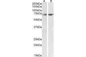 ABIN1590085 (2 μg/mL) staining of Human Cerebellum (A) and Rat Lung (B) lysate (35 μg protein in RIPA buffer). (SYVN1 抗体  (Internal Region))