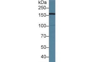 Detection of AIM1 in Human 293T cell lysate using Polyclonal Antibody to Absent In Melanoma 1 (AIM1) (AIM1 抗体  (AA 1502-1719))