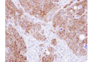 IHC-P Image Immunohistochemical analysis of paraffin-embedded SW480 xenograft, using DARS, antibody at 1:500 dilution. (DARS 抗体)