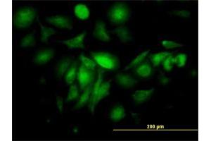 Immunofluorescence (IF) image for anti-Ferritin, Light Polypeptide (FTL) (AA 1-175) antibody (ABIN947883)