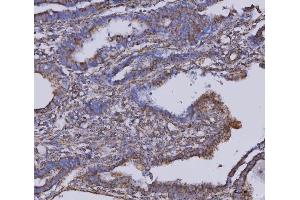IHC analysis of MDH2 using anti-MDH2 antibody (ABIN7602617).