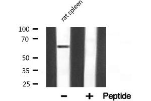 Western blot analysis of NF-kappaB p65 expression in Rat spleen lysate