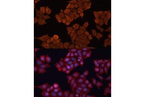Immunofluorescence (IF) image for anti-Hydroxysteroid (17-Beta) Dehydrogenase 1 (HSD17B1) (AA 1-328) antibody (ABIN6142002)