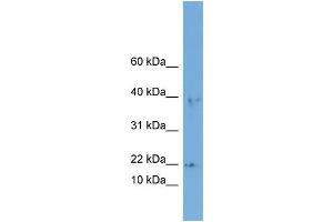 Western Blotting (WB) image for anti-Actin Related Protein 2/3 Complex, Subunit 3, 21kDa (ARPC3) (Middle Region) antibody (ABIN2784769)