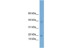 WB Suggested Anti-ARPC3  Antibody Titration: 0. (ARPC3 抗体  (Middle Region))