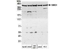 anti-pi-3-Kinase-Related Kinase SMG-1 (SMG1) (AA 1250-1300) antibody