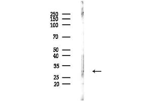 anti-Potassium Channel Subfamily K Member 1 (KCNK1) (N-Term) antibody