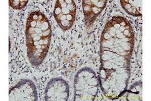 Immunoperoxidase of monoclonal antibody to KRT20 on formalin-fixed paraffin-embedded human colon tissue. (KRT20 抗体  (AA 1-424))