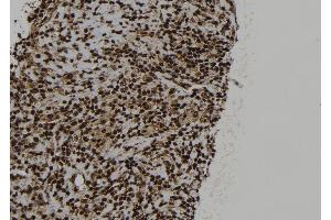ABIN6273323 at 1/100 staining Human spleen tissue by IHC-P. (SRP54 抗体)