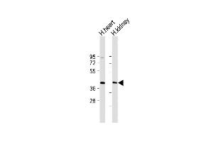 All lanes : Anti-DACL2 Antibody (Center) at 1:2000 dilution Lane 1: Human heart lysate Lane 2: Human kidney lysate Lysates/proteins at 20 μg per lane. (AADACL2 抗体  (AA 156-182))