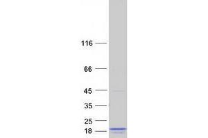 Validation with Western Blot