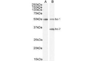 ABIN185645 (2µg/ml) staining of isoform 1 Human Brain (A) and isoform 1+2 (B) lysate (35µg protein in RIPA buffer). (Chromogranin A 抗体  (Internal Region))