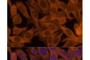Immunofluorescence analysis of HeLa cells using NME1 Polyclonal Antibody at dilution of 1:100. (NME1 抗体)