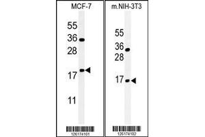 (LEFT)Western blot analysis of BTG1 Antibody in MCF-7 cell line lysates (35ug/lane). (BTG1 抗体  (AA 92-118))