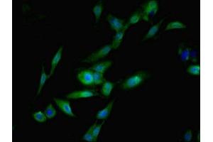 Immunofluorescent analysis of Hela cells using ABIN7169843 at dilution of 1:100 and Alexa Fluor 488-congugated AffiniPure Goat Anti-Rabbit IgG(H+L) (SGTA 抗体  (AA 1-120))