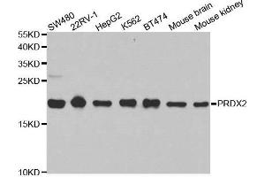 Western blot analysis of extracts of various cell lines, using PRDX2 antibody. (Peroxiredoxin 2 抗体  (AA 1-142))