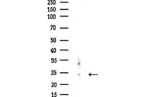 anti-Ribosomal Protein L18 (RPL18) antibody