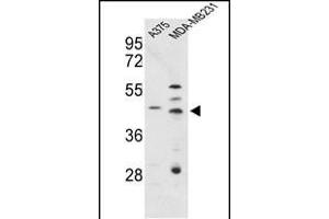 Western blot analysis of CTSD Antibody (C-term) (ABIN653399 and ABIN2842857) in , MDA-M cell line lysates (35 μg/lane). (Cathepsin D 抗体  (C-Term))