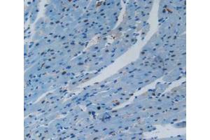 IHC-P analysis of Mouse Heart Tissue, with DAB staining. (VCAM1 抗体  (AA 116-309))