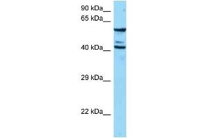 WB Suggested Anti-ESAM Antibody   Titration: 1. (ESAM 抗体  (N-Term))