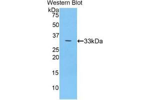 Western blot analysis of the recombinant protein. (Ceruloplasmin 抗体  (AA 789-1065))