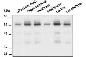 Western Blotting (WB) image for anti-Protein tyrosine Phosphatase, Receptor Type, R (PTPRR) antibody (ABIN1108794) (PTPRR 抗体)
