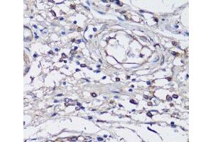 Immunohistochemistry (Paraffin-embedded Sections) (IHC (p)) image for anti-NLR Family, CARD Domain Containing 4 (NLRC4) antibody (ABIN7008065)